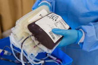 Метод переливания плазмы как способ лечения коронавируса показывает себя довольно эффективно. Данным путём в больнице №40 спасли уже 32 тяжелобольных пациентов.